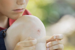 Hp 19060 Avery D Girl Tapes Knee