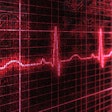 Hp 19149 I Stock Pulse Trace