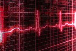 Hp 19149 I Stock Pulse Trace