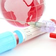 Hp 19867 I Stock Globe And Blood Serum 000011569294 X Small