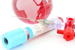 Hp 19867 I Stock Globe And Blood Serum 000011569294 X Small