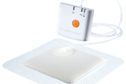 Hp 19965 S N Prn Smith And Nephew Npwt 1y High