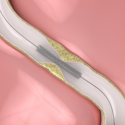 Coronary stent