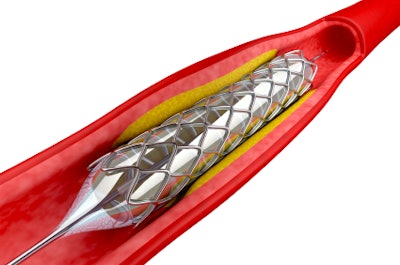 Angioplasty stent