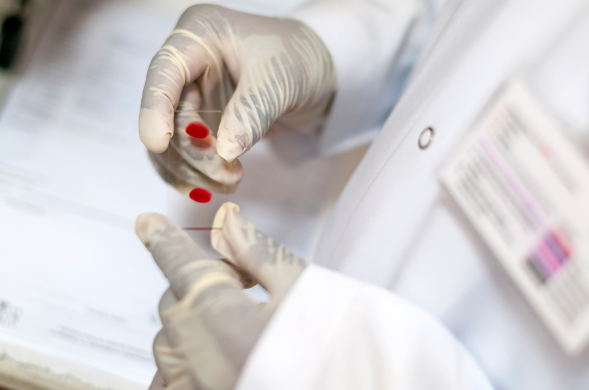 Instruments and consumables used for IVD [In Vitro Diagnostics] testing represent a $51.3 billion market in 2013, with a compound annual growth rate (CAGR) forecast of 7.2% between 2012 and 2017.