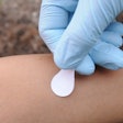 Administering measles vaccine with a microneedle patch is expected to be easier than getting a shot. Photo credit: Gary Meek, Georgia Tech