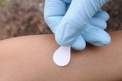 Administering measles vaccine with a microneedle patch is expected to be easier than getting a shot. Photo credit: Gary Meek, Georgia Tech