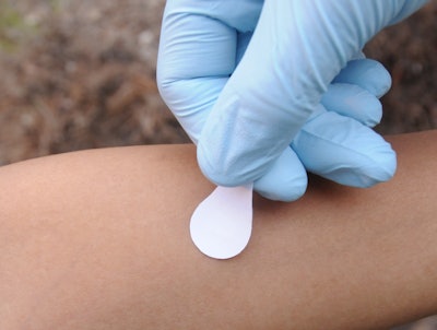 Administering measles vaccine with a microneedle patch is expected to be easier than getting a shot. Photo credit: Gary Meek, Georgia Tech
