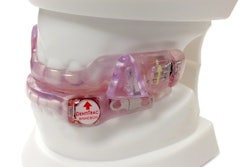 Braebon's DentiTrac® is an integrated wearable micro-recorder and web cloud portal combination for the objective measurement of oral appliance compliance measurement for sleep apnea.