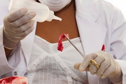 Rise in food recalls catalyzes development of improved safety technologies, finds Frost & Sullivan.