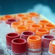 Temperature-controlled packaging is necessary for many products, including the human serum samples shown here.