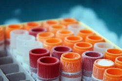 Temperature-controlled packaging is necessary for many products, including the human serum samples shown here.