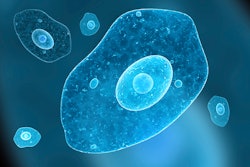 International Stem Cell Corp.’s Phase 1 clinical trial in Australia for Parkinson’s disease will be supported by Cryoport logistics services. This image is for illustrative purposes only.
