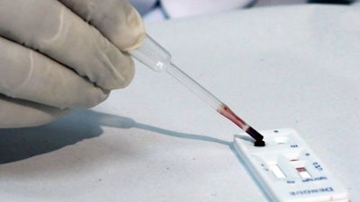 Zika Blood Test / Image: foxnews.com