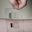 Diabetes 'graphene tattoo' / Photo: newsweek.com