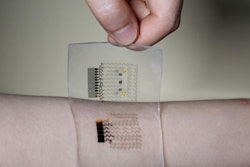 Diabetes 'graphene tattoo' / Photo: newsweek.com