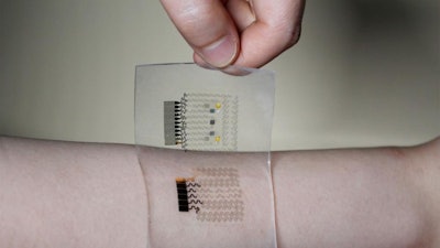 Diabetes 'graphene tattoo' / Photo: newsweek.com