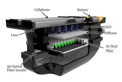 Diagnostic Phone Attachment / Image: Aydogan Ozcan/UCLA