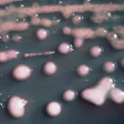Klebsiella pneumoniae bacteria