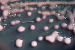Klebsiella pneumoniae bacteria / Photo: CDC