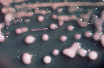 Klebsiella pneumoniae bacteria / Photo: CDC