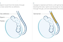 Vasalgel Male Contraceptive / Image: Parsemus Foundation