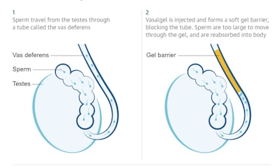 Vasalgel Male Contraceptive / Image: Parsemus Foundation