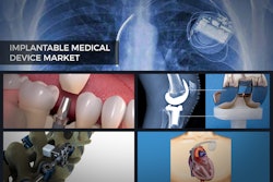 Despite attaining maturity in developed regions and cost issues, implantables are predicted to grow worldwide, says a new report.