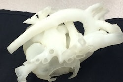 3D Printed Heart Model from Stratasys / Image: Stratasys