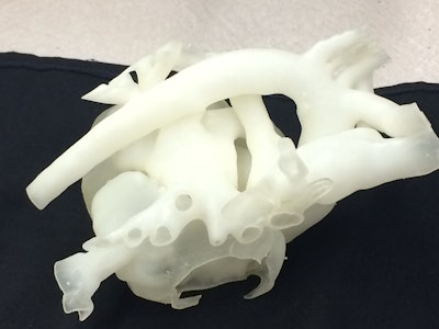 3D Printed Heart Model from Stratasys / Image: Stratasys