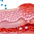 Eczema / Image: ET Healthworld