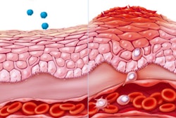 Eczema / Image: ET Healthworld