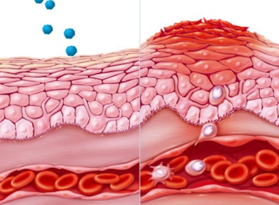 Eczema / Image: ET Healthworld