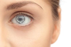 Smart Contact Simulation / Image: Jack Forkey