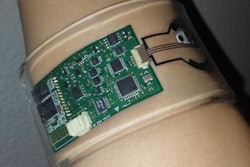 Wristband Sweat Device / Image: Sam Emaminejad / Stanford University