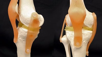 3D-Printable Knee / Image: Feichen Yang, Duke