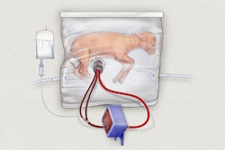 The fluid-filled incubation system / Image: AP