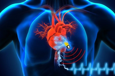 Body-Powered Pacemaker / Image: UCLA