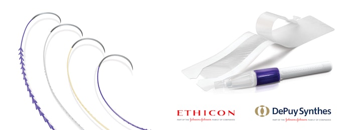 Ethicon and DePuy Synthes recently announced they were joining forces to introduce customized wound closure kits for orthopaedic surgery, including STRATAFIX™ and DERMABOND® suture closure devices.