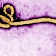 Ebola Virus / Image: CNN
