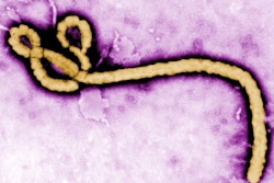 Ebola Virus / Image: CNN