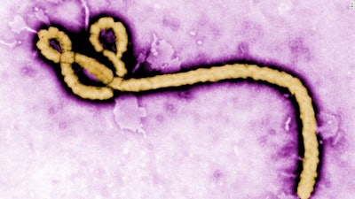 Ebola Virus / Image: CNN