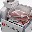 Heart in a Box / Image: TransMedics