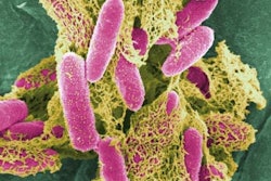 E. coli bacteria under a microscope. / Image: ArtsOnEarth