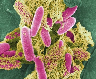 E. coli bacteria under a microscope. / Image: ArtsOnEarth