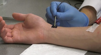 Nanochip on skin getting the magic touch. Image: Ohio State University