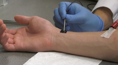Nanochip on skin getting the magic touch. Image: Ohio State University