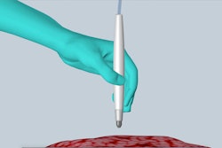 Cancer Diagnostic Pen / Image: UT Austin