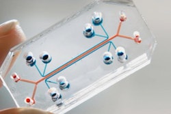 Placenta-On-A-Chip / Image: Harvard University
