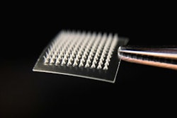 Microneedle Skin Patch / Image: CUMC